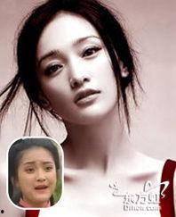 明星都打瘦脸针吗,揭秘瘦脸针的流行之谜